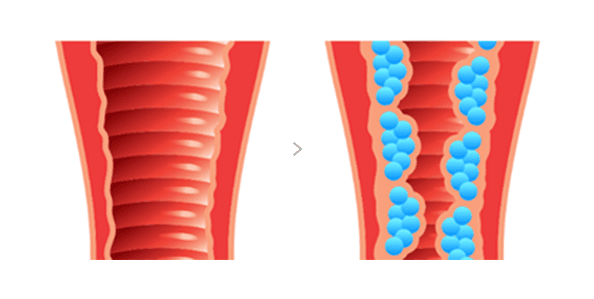 V植入 术前术后 (1)