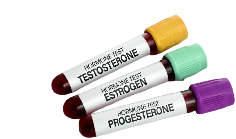 호르몬 패널 검사