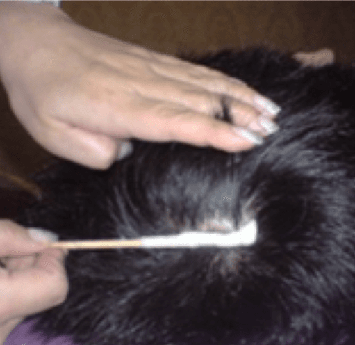 Scalp Brush & Scaling