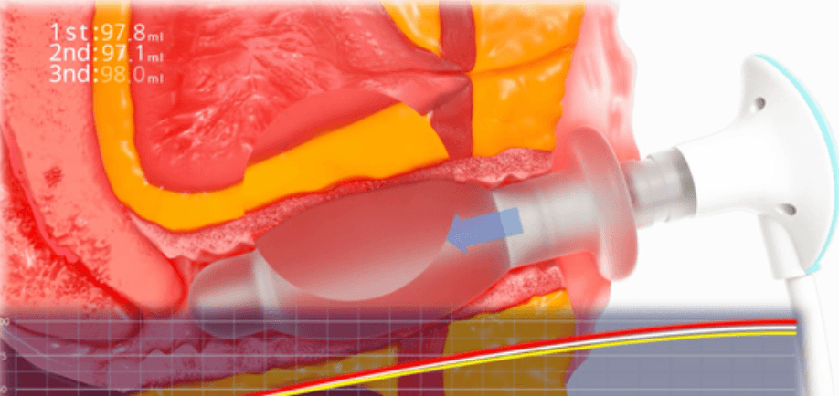 Air Volume Measurement & Diagnosis